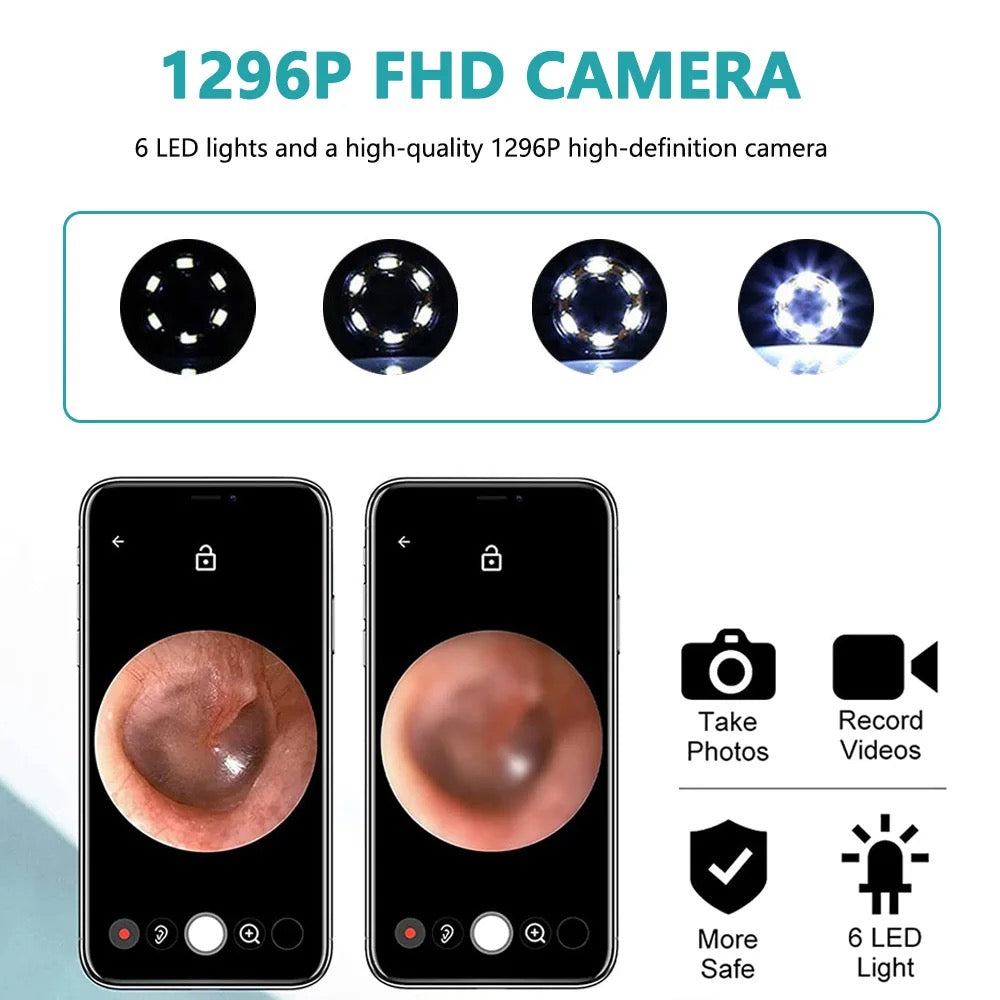 Intelligent Ear Wax Cleaner with 500MP Camera منظف شمع الأذن الذكي بكاميرا 500