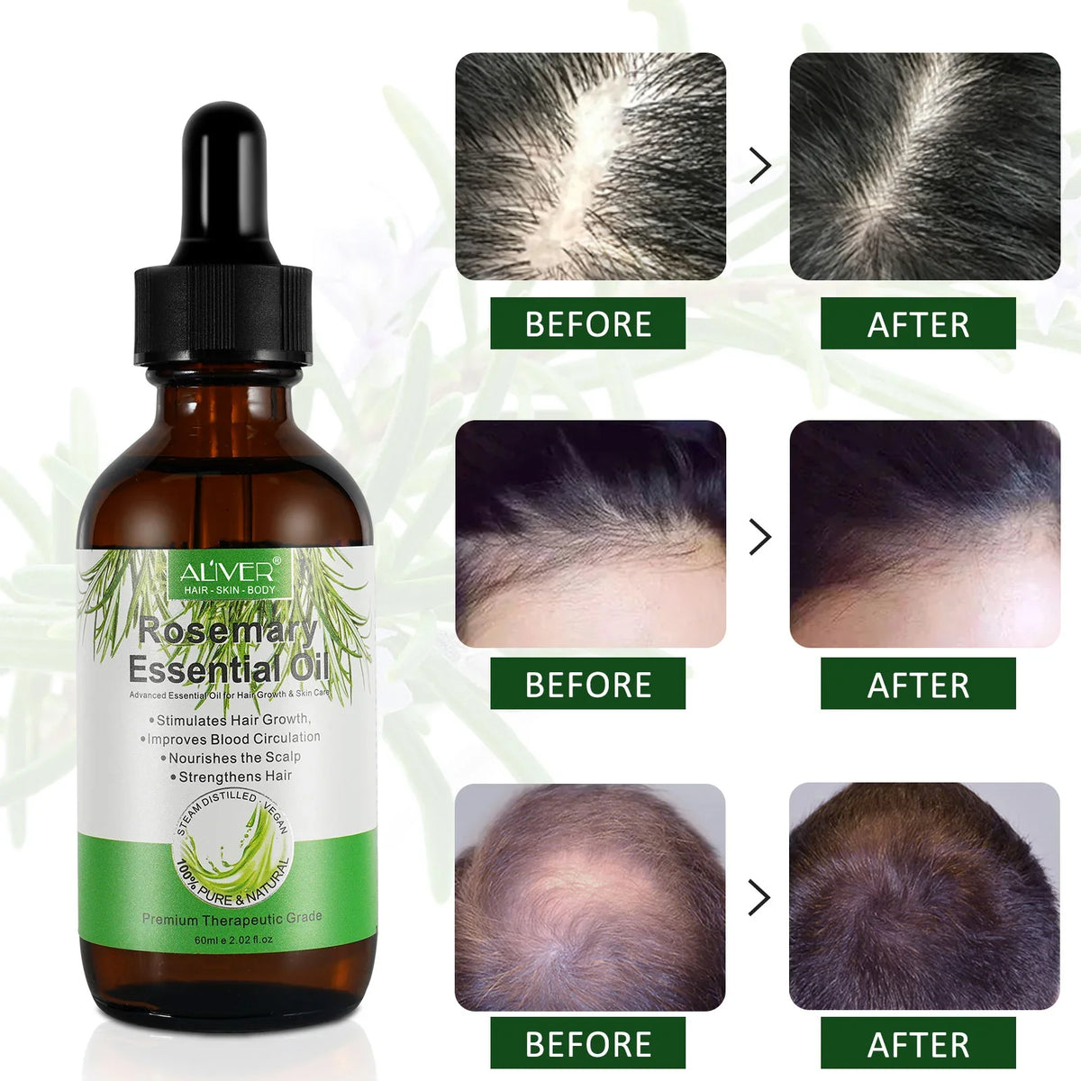 ALIVER Organic Rosemary Oil زيت إكليل الجبل العضوي