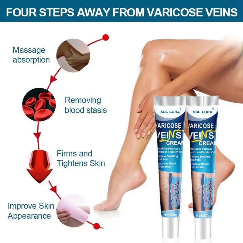 Varicose veins