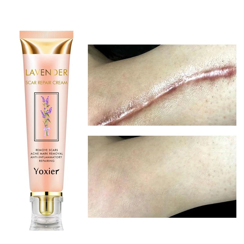 Yoxier Lavender Scar Repair Cream