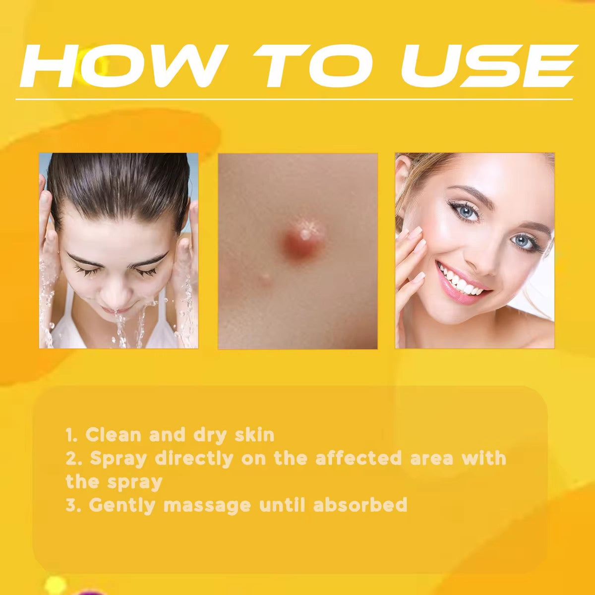 Skin Tag & Mole Remover Spray بخاخ إزالة الزوائد الجلدية والشامات