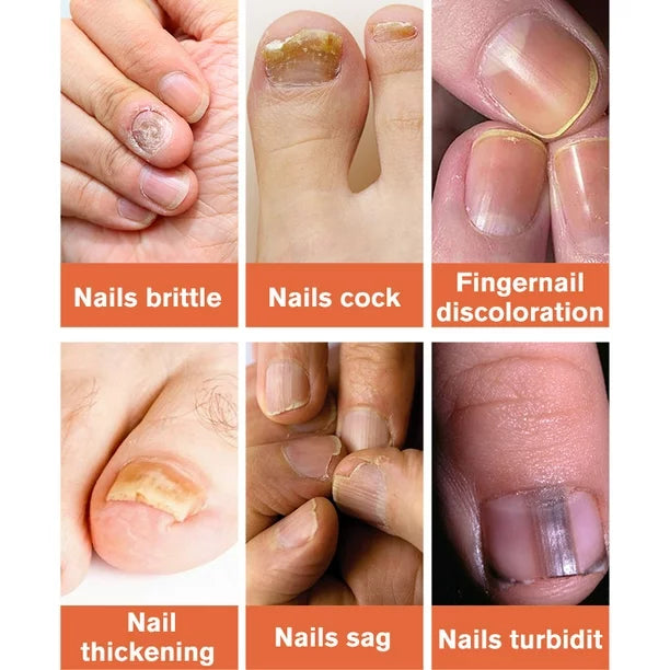 Nail repair essence
