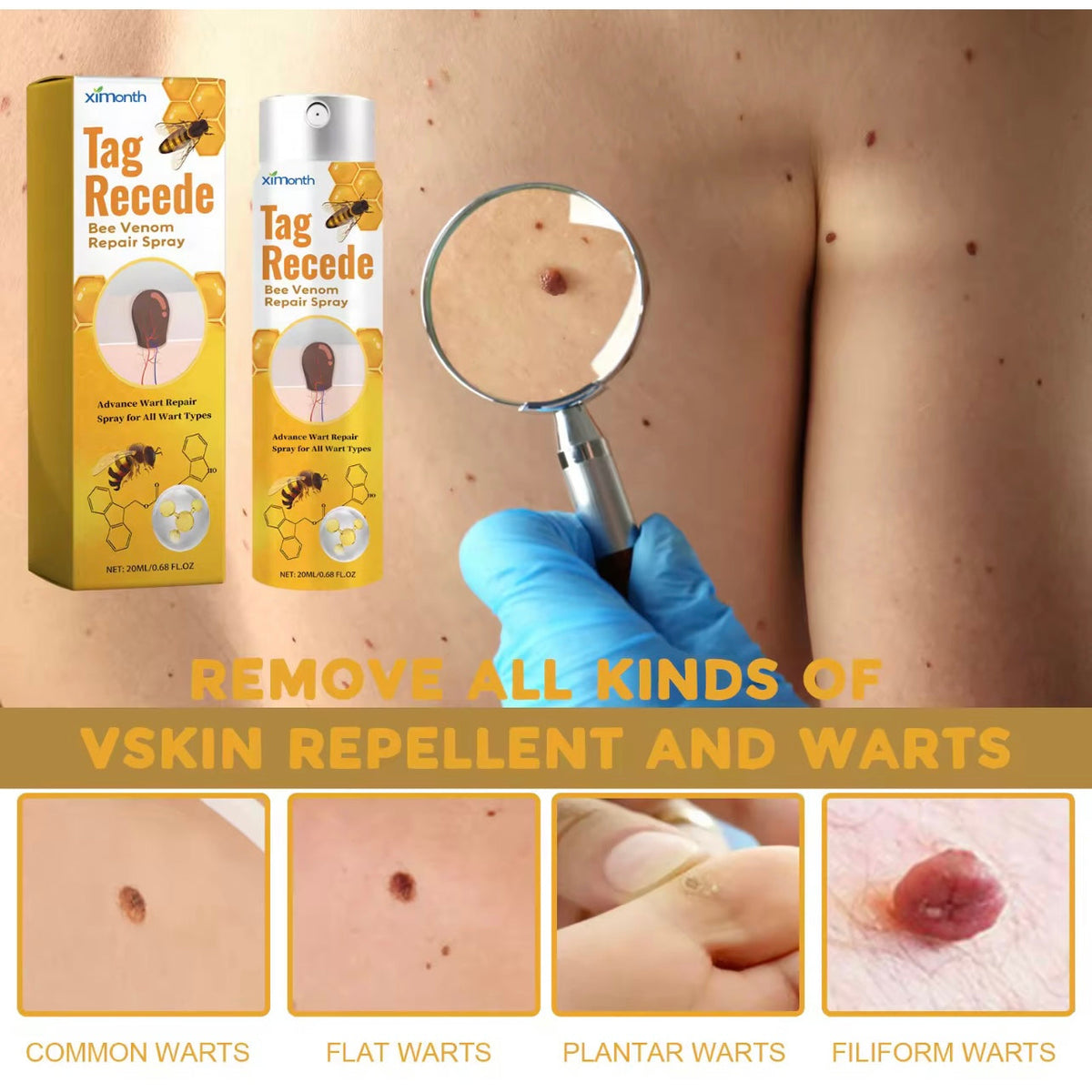 Skin Tag & Mole Remover Spray بخاخ إزالة الزوائد الجلدية والشامات