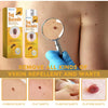 Skin Tag & Mole Remover Spray