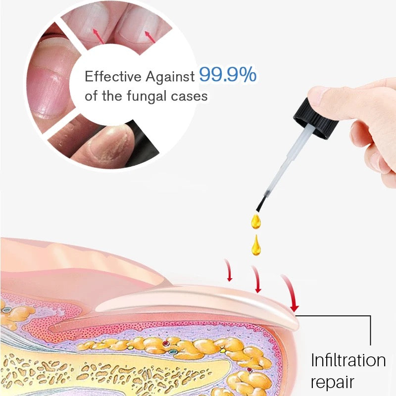Nail repair essence