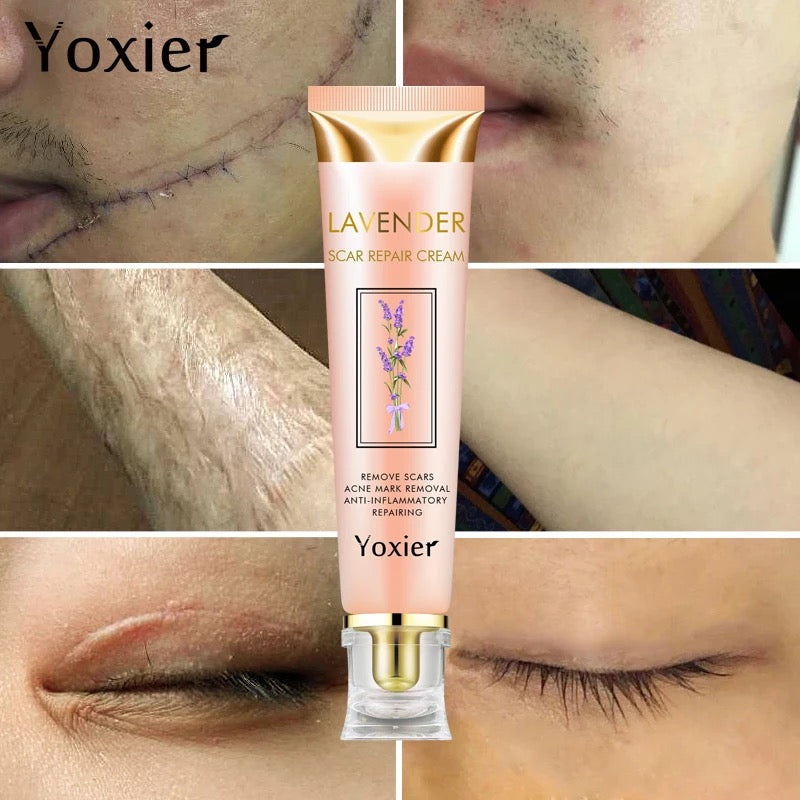 Yoxier Lavender Scar Repair Cream كريم إصلاح الندوب بالخزامى