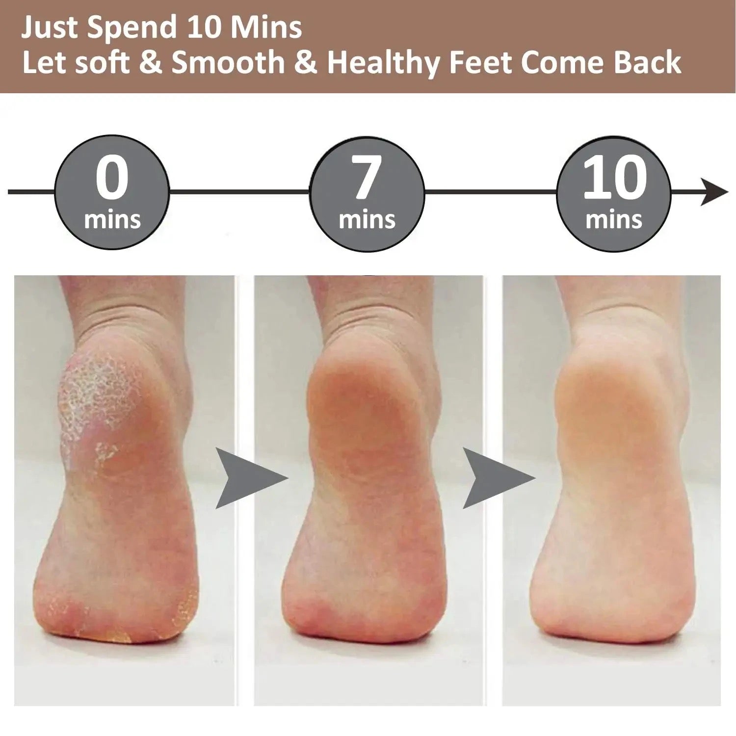 Dead Skin Feet & Callus Remover