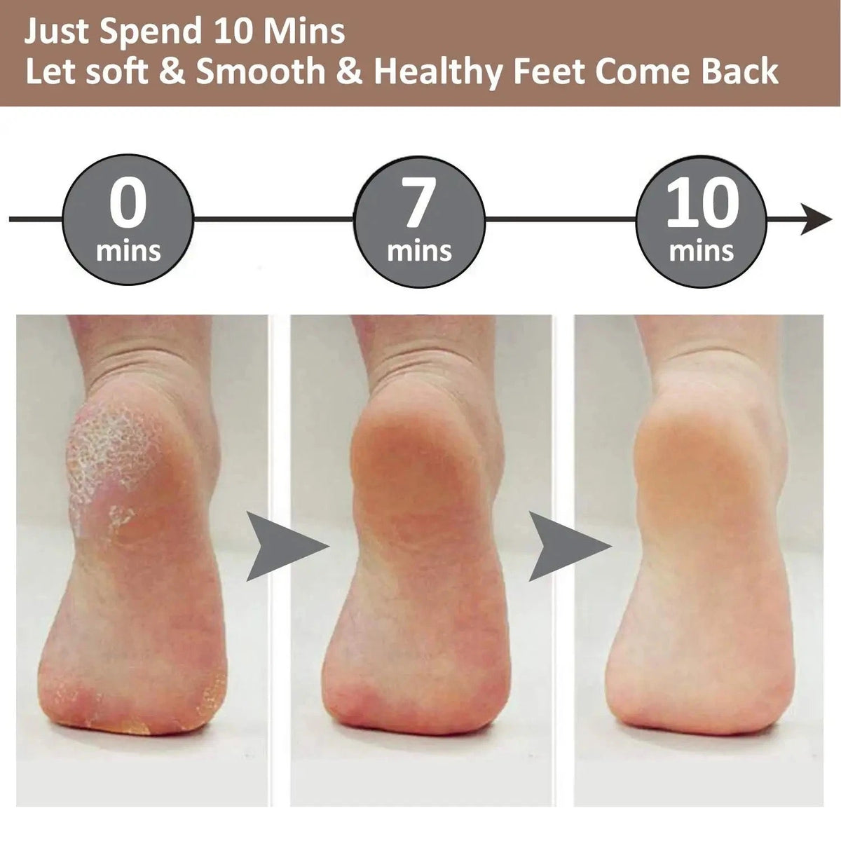 Dead Skin Feet & Callus Remover مزيل الجلد الميت والجلد المتصلب للقدم