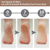 Dead Skin Feet & Callus Remover