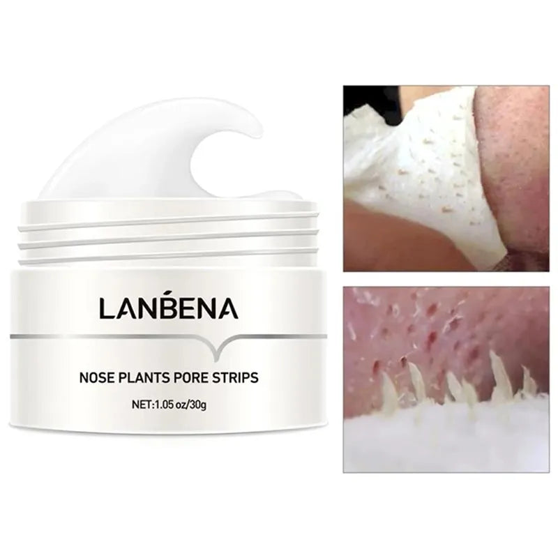 LANBENA™ Cream + Pore Strips (60PCS)