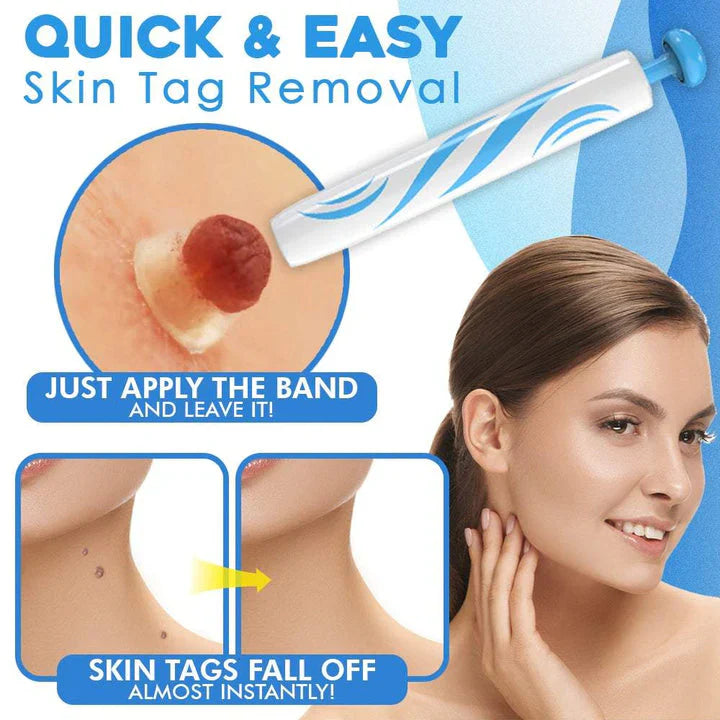 Skin Tag Removal Kit | Made In United Kingdom طقم إزالة الزوائد الجلدية صنع في المملكة المتحدة