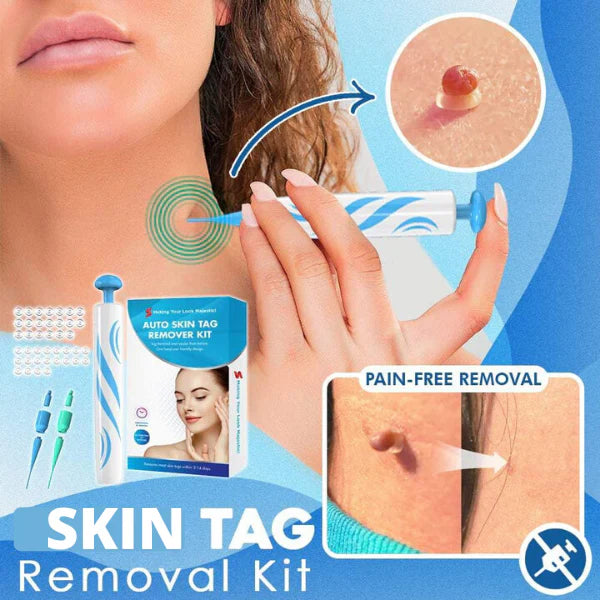 Skin Tag Removal Kit | Made In United Kingdom طقم إزالة الزوائد الجلدية صنع في المملكة المتحدة