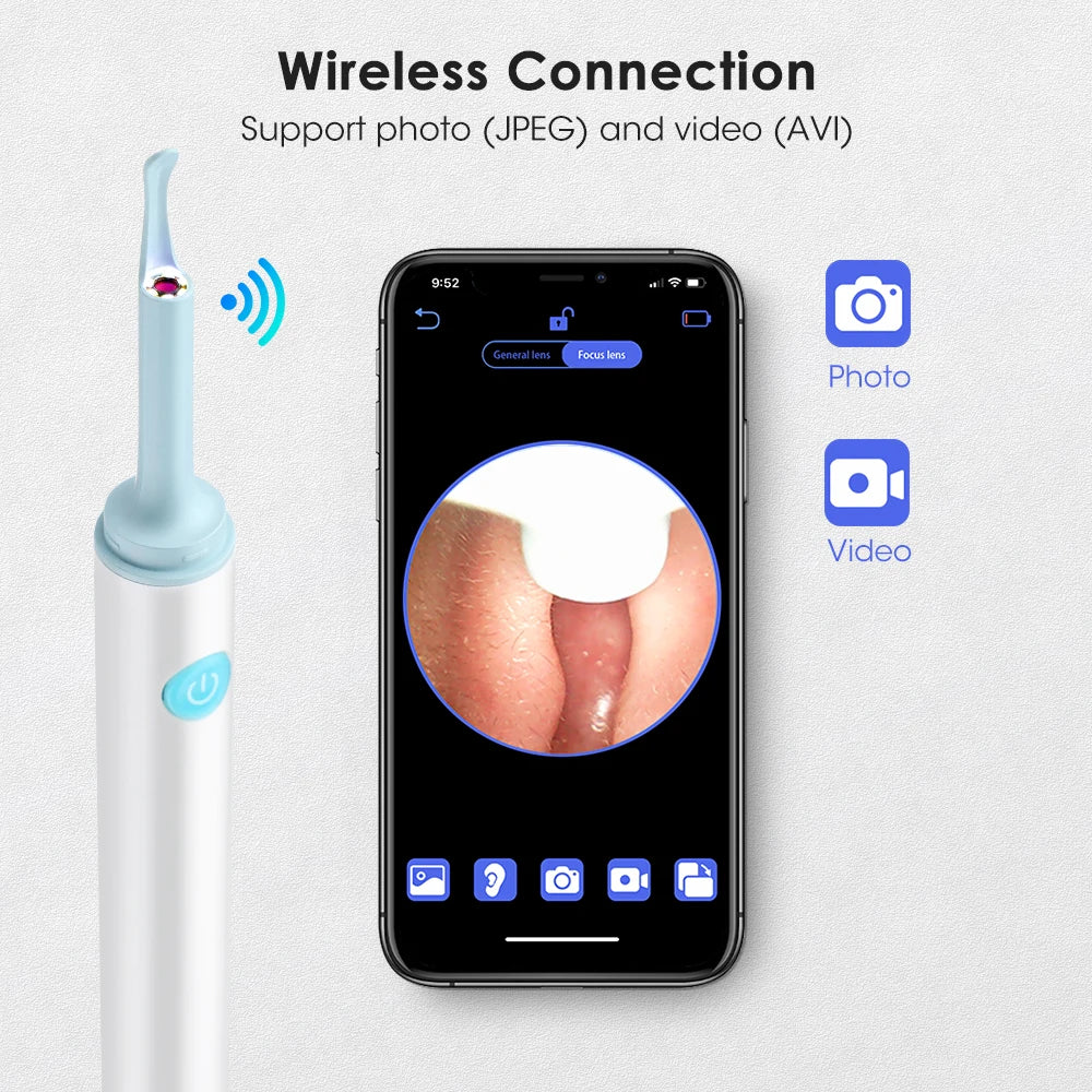 Intelligent Ear Wax Cleaner with 500MP Camera منظف شمع الأذن الذكي بكاميرا 500