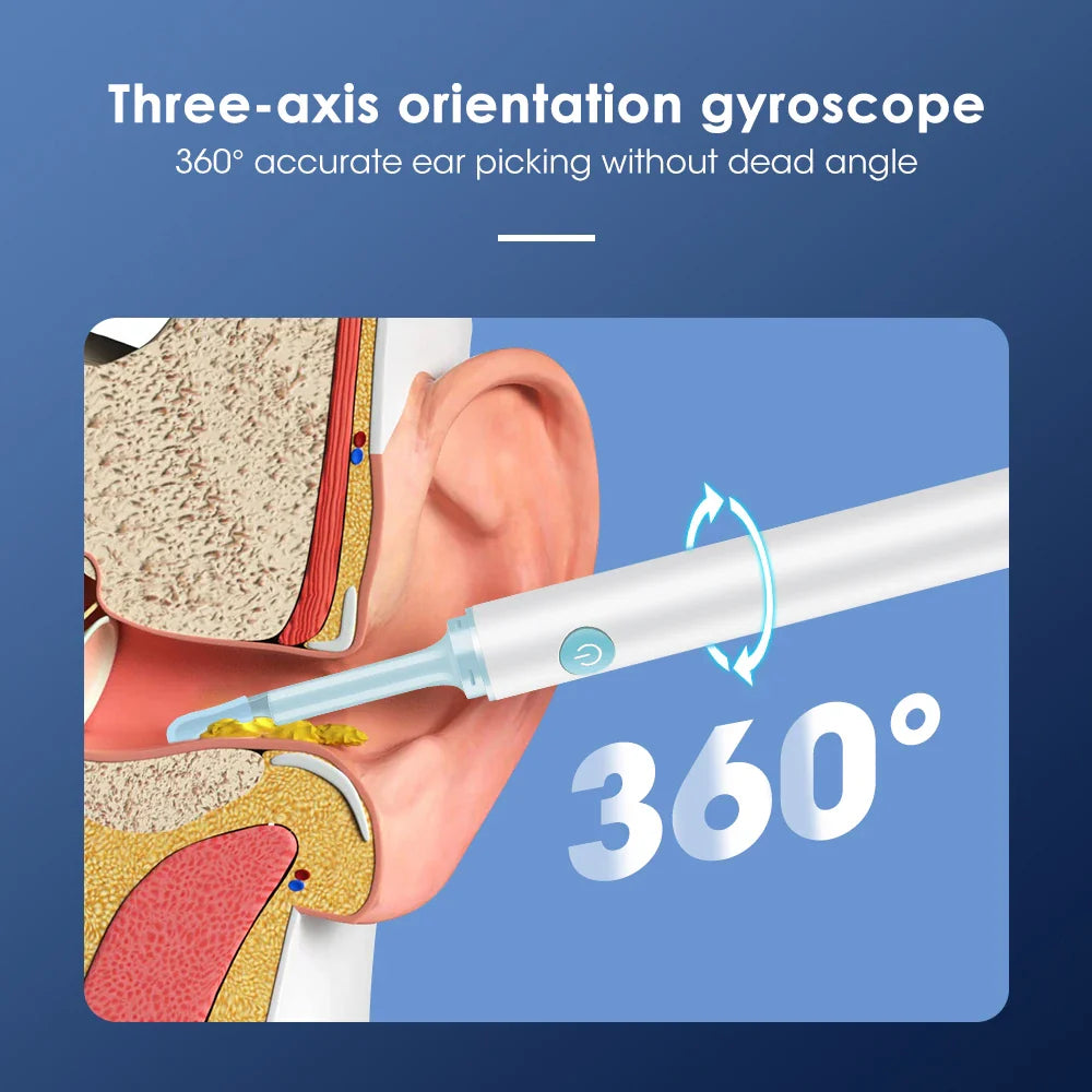 Intelligent Ear Wax Cleaner with 500MP Camera منظف شمع الأذن الذكي بكاميرا 500
