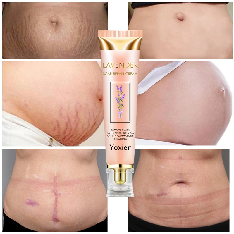 Yoxier Lavender Scar Repair Cream كريم إصلاح الندوب بالخزامى